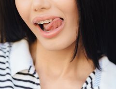 HKT48・指原莉乃 歯列の矯正で滑舌に悪影響が…『さしはらりの』が言えない！？