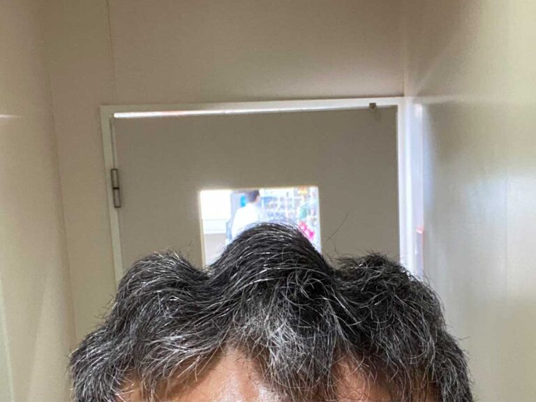 男性の髪の毛