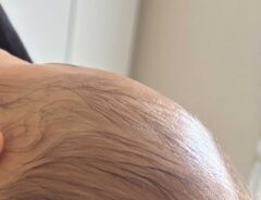 赤ちゃんの画像