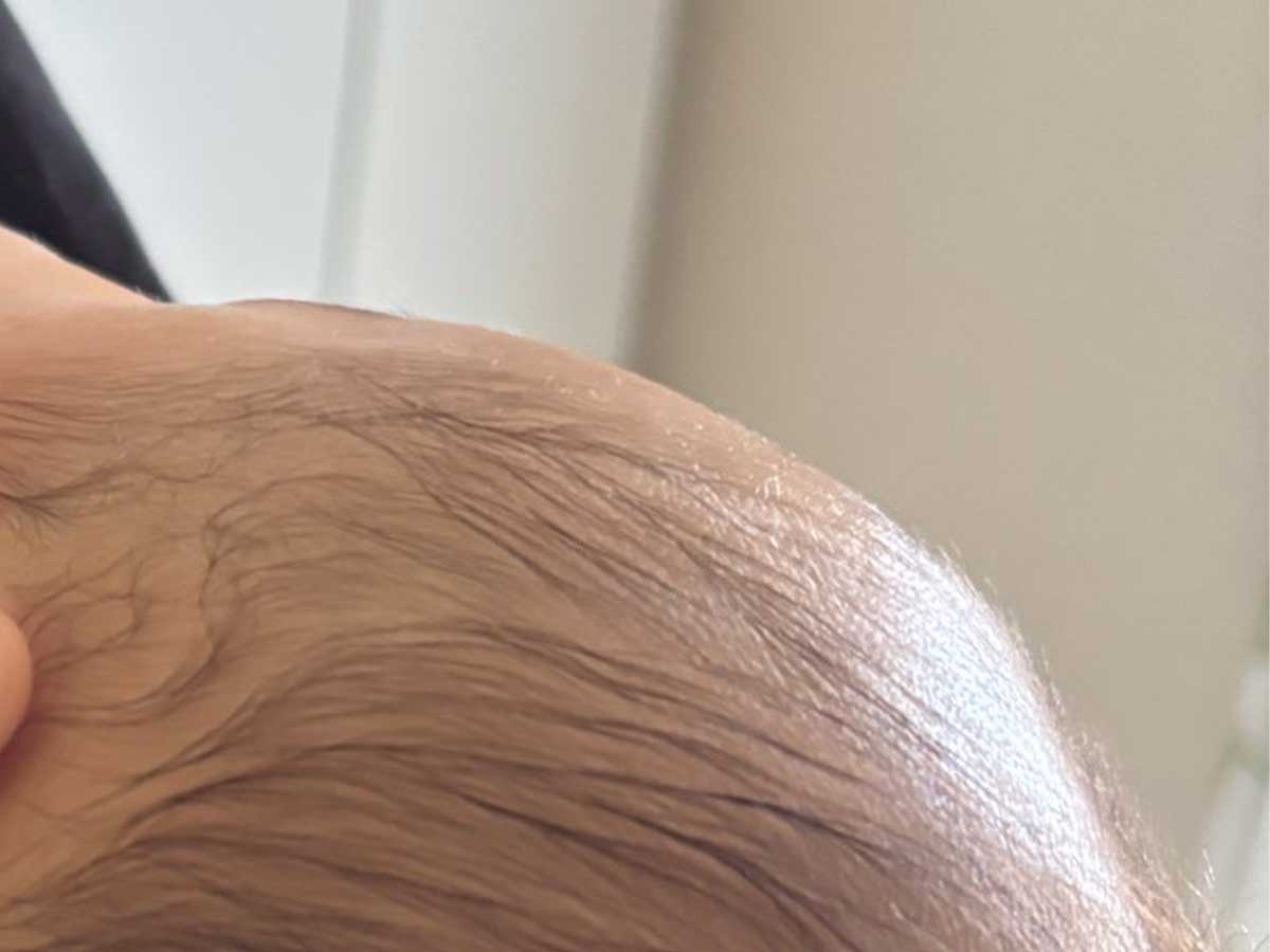 赤ちゃんの画像