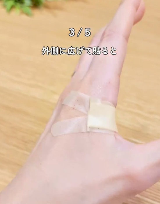 水かき部分に貼られた絆創膏