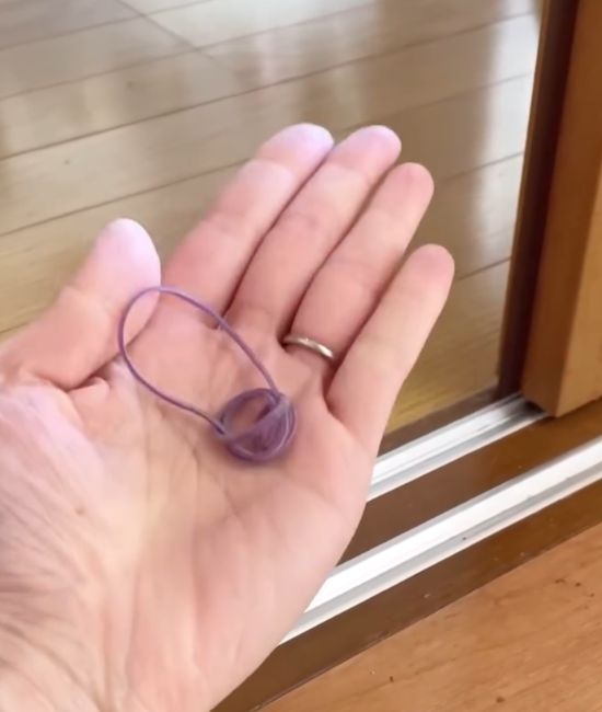 輪ゴムに髪の毛などが絡み付いている様子