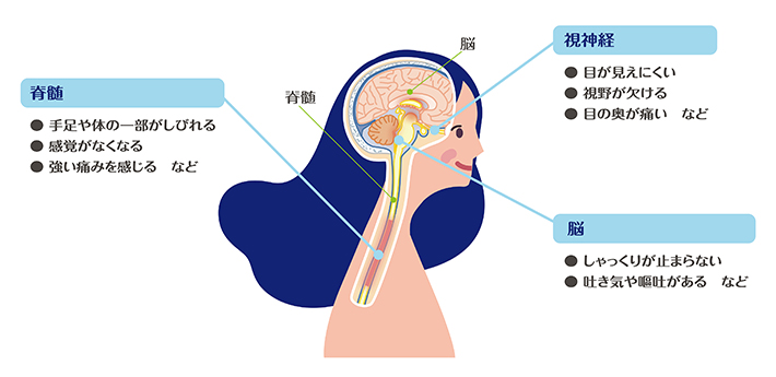 中外製薬のウェブサイトの画像