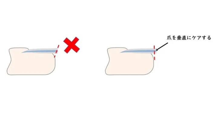 『テコ型』の爪切りの使い方の画像