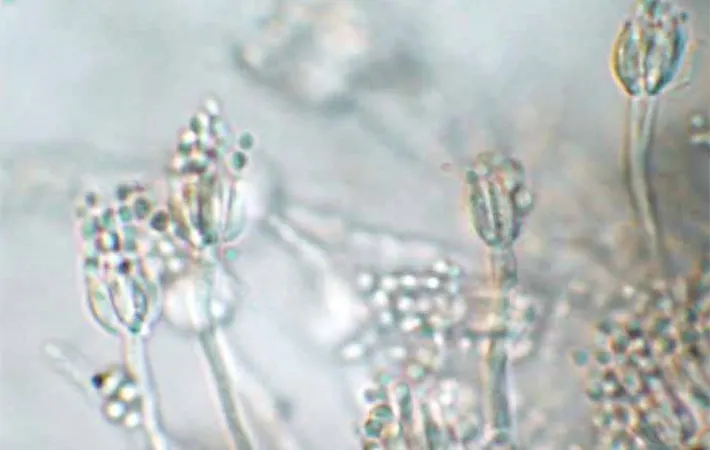 検査対象のスマートフォンのカバーケースから見つかったアオカビの顕微鏡写真（撮影：エフシージー総合研究所）