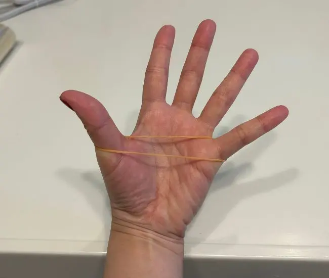 手に輪ゴムをかけた様子