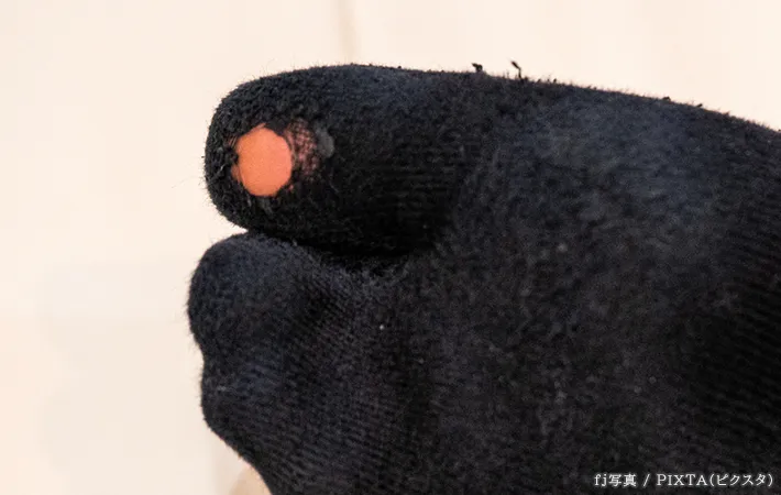 穴の開いた靴下の写真