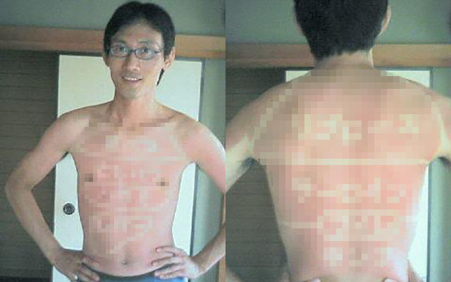 夏にハシャいじゃダメだぜ ９年前の日焼け跡を見せる芸人のボディに驚愕 Grape グレイプ