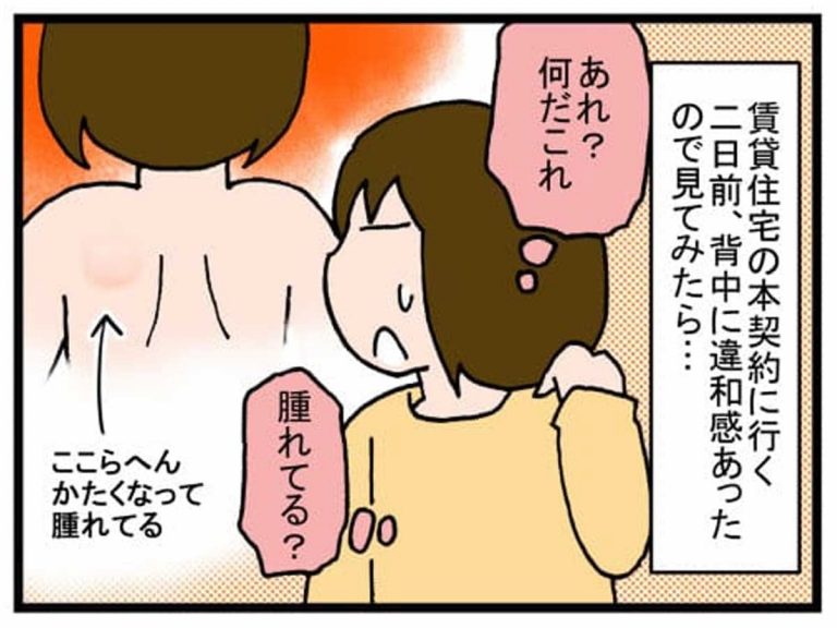 引っ越し前 背中に違和感 悪化したので病院で診てもらったら Grape グレイプ