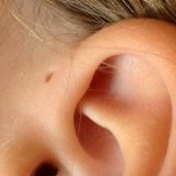 あなたにもある? 日本人の2〜3%が持つと言われている耳の付け根の穴とは あなたにもある? 日本人の2〜3%が持つと言われている耳の付け根の穴とは
